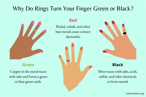 how to fix green finger from ring